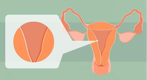 子宫内膜薄怀孕了能保住胎吗？