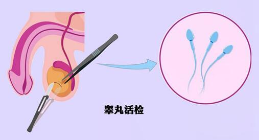 55岁男性睾丸穿刺没有精子还有希望生育吗?