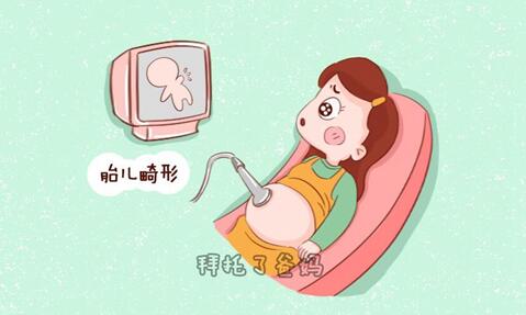 什么原因会导致胎儿畸形?什么样的人怀孕容易出现胎儿畸形?