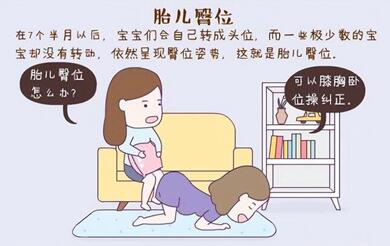 胎儿臀位怎么纠正?胎儿臀位是什么原因造成的?