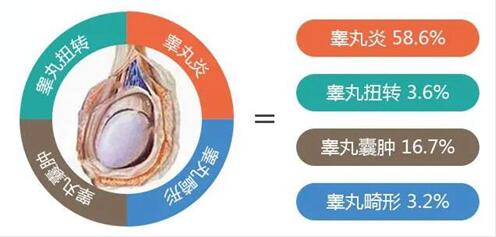 男性睾丸异常会造成哪些危害呢?睾丸检查有哪些项目呢?