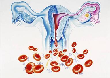 子宫先天性畸形是什么?子宫畸形可以分为哪些类型?