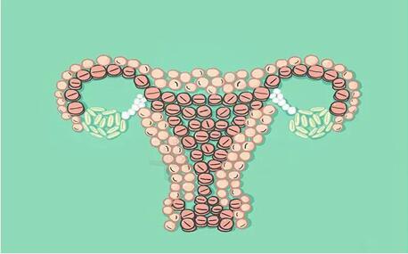 单角子宫能自然受孕吗?子宫畸形可以做试管婴儿吗?