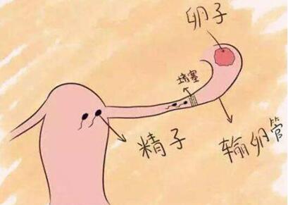 输卵管不通影响女性正常排卵吗?