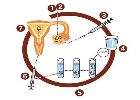 做试管婴儿有次数的限制吗?做试管婴儿失败了怎么办?