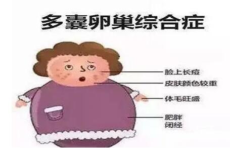 什么是多囊性卵巢综合征?干细胞可以治疗不孕不育症吗?