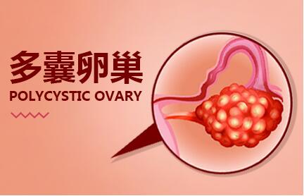 什么是多囊性卵巢综合征?干细胞可以治疗不孕不育症吗?