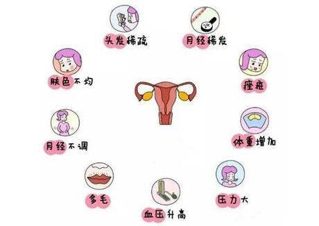多囊卵巢患者不来月经怎么办?七个小秒招解决月经烦恼!