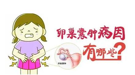 卵巢囊肿会导致不孕吗?卵巢囊肿什么情况下需要做手术?