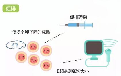 做试管一般有多少个卵泡才能做?试管一般取多少个卵是最好的?