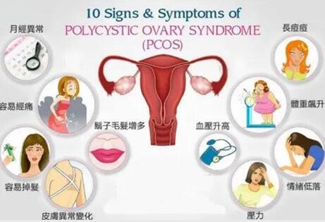 多囊卵巢综合征对身体的危害?多囊性卵巢综合征怎么治疗?