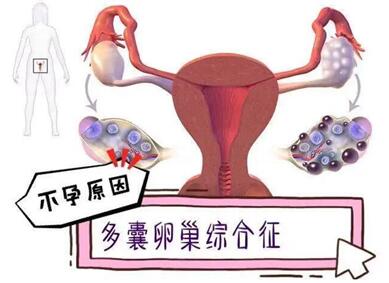 多囊卵巢会对女性造成哪些危害?多囊卵巢怎么治疗效果最好?