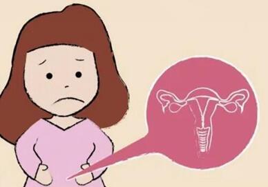 治疗多囊性卵巢综合症的最佳方法?多囊的诊断标准是什么?