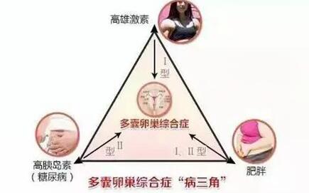 多囊卵巢怎么调理最有效?多囊卵巢一般要治多久?