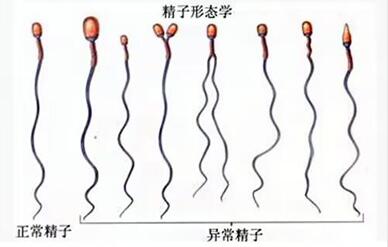 男人精子活力多少可以做人工授精?人工授精对精子要求!