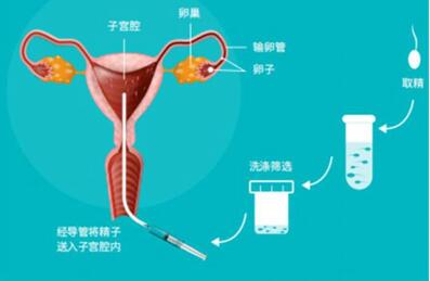 2024石家庄供卵生殖机构公布,附供卵机构选择技巧!