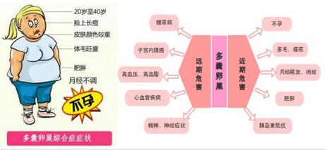 多囊卵巢综合征患者如何保养子宫?