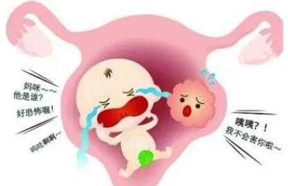多囊卵巢综合症做试管婴儿前怎么调理身体?