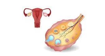 做试管说卵巢功能不好怎么办?