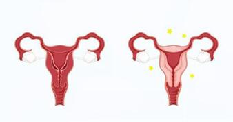 卵巢早衰与性生活不足有关吗?怎么延缓卵巢功能早衰?