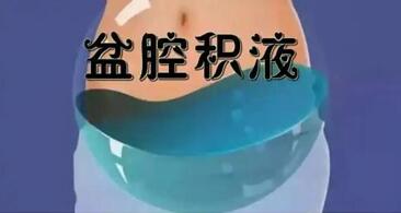 盆腔积液是什么原因引起的?分析盆腔积液的三大原因!