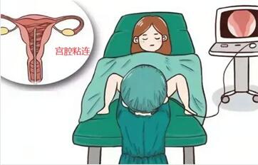 宫腔粘连典型症状有哪些?宫腔粘连如何处理呢?