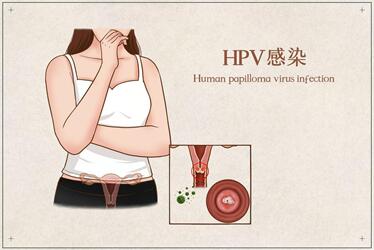 HPV阳性可以做试管婴儿吗?