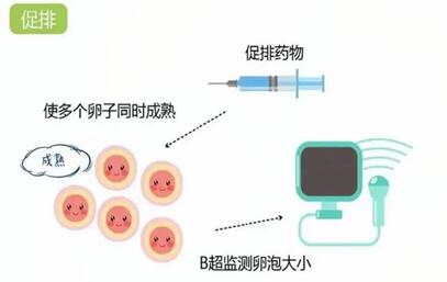 试管婴儿短方案多次促排不成功原因有哪些?促排失败的注意事项!