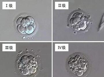 三级胚胎养成囊的几率有多大?三级胚胎质量怎么样?