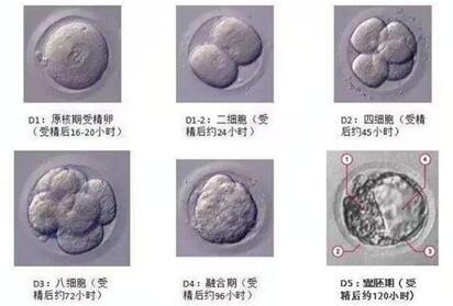 移植4ab囊胚出生后是男孩多还是女孩多?生男生女和胚胎等级无关!