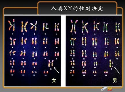 14号染色体微缺失包括哪些病?