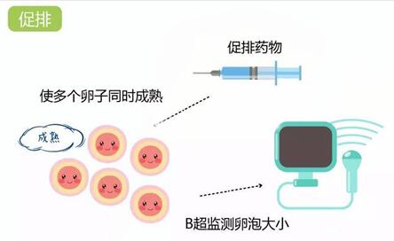 试管卵泡穿刺后多久开始促排?卵泡穿刺术后应注意什么?