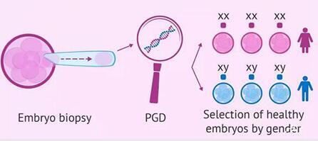 第三代试管PGS技术可以筛查出哪些遗传疾病?