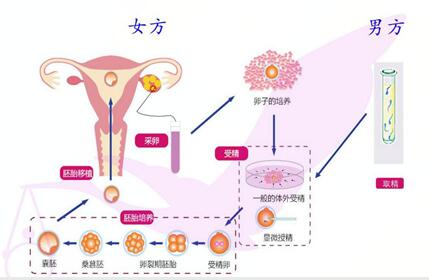 1pn胚囊到底可以移植吗?1pn胚胎是属于什么级别的?