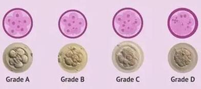 3AA囊胚质量怎么样?评估单胚胎移植着床成功率!