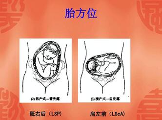 孕妇分娩前怎么判断胎儿的胎方位?小妙招你会吗!