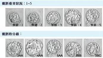 胚胎9c属于几级的?怀孕后如何判断9c胚胎发育质量?