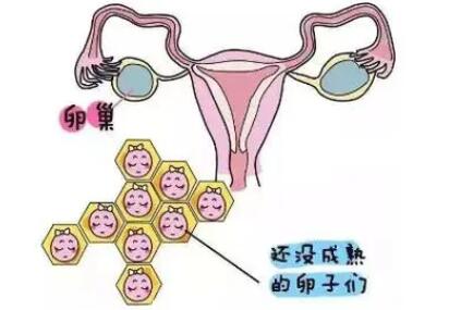卵泡萎缩算是不孕吗?卵泡萎缩可以促排怀孕吗?