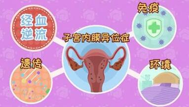 子宫内膜异位症患者可以试管吗?女性朋友如何预防子宫内膜异位症?