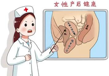 产后宫底下降慢怎么办?几个小妙招助你快速恢复!