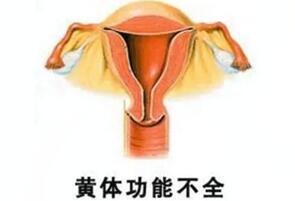 警惕!黄体功能不足易流产,孕期最好谨慎一点!
