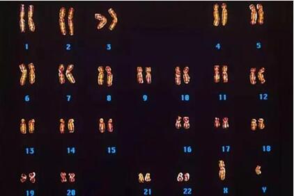 3号染色体异常严不严重?它决定了什么?