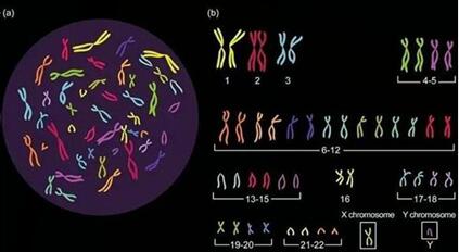 4号染色体异常是什么原因引起的?可能是遗传引起的!