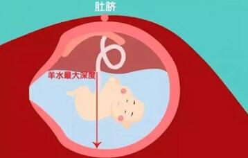 羊水少吃什么补得快?早了解早补充