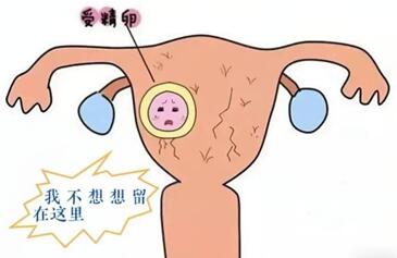 影响受精卵着床的原因有哪些?快来看看你中招了没