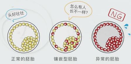 嵌合体囊胚一般是男宝是真是假?这几个移植的误区要认清
