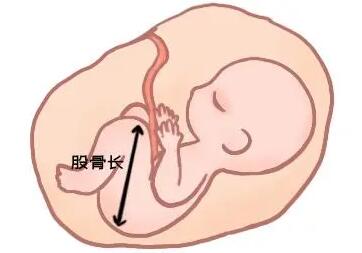 怎么通过股骨长看男女?股骨长能看出宝宝男女吗?