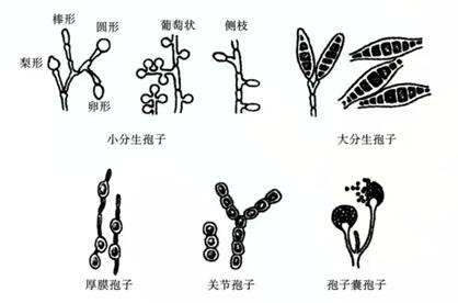 白带检查真菌孢子是什么意思?检查白带能查出什么病